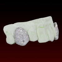 Singer Fang Custom Moissanite Grillz