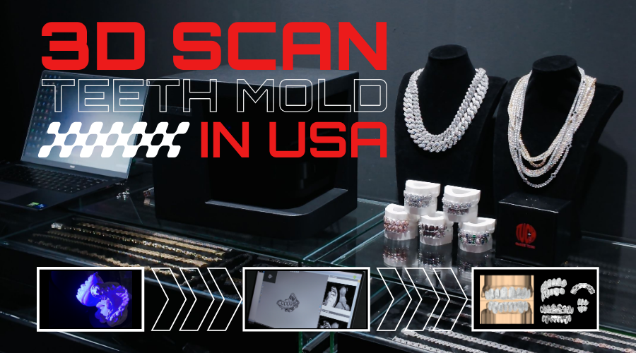 3D Scan Your Teeth Mold in the USA