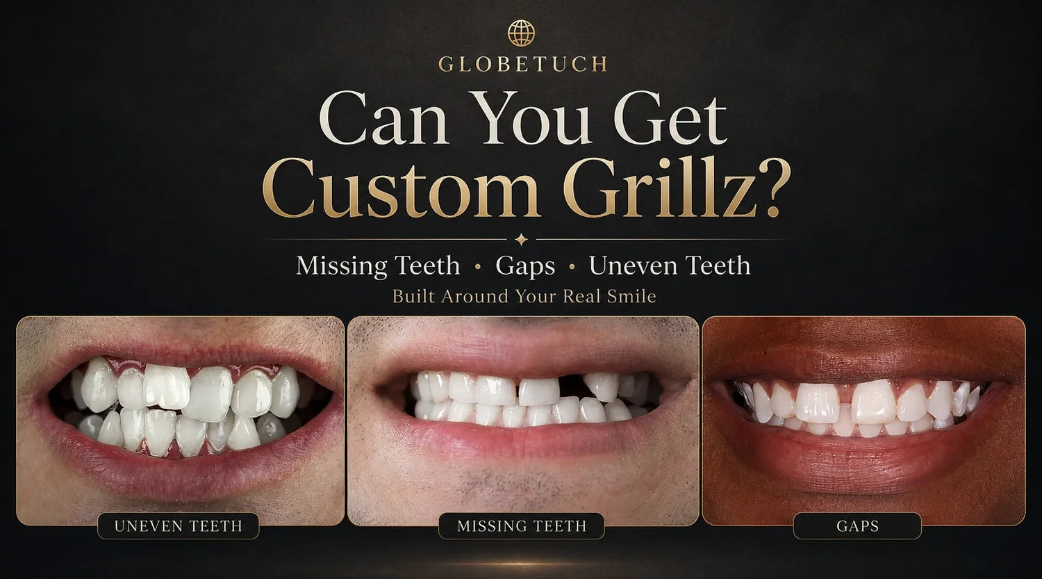 Can You Get Custom Grillz With Missing Teeth, Gaps or Uneven Teeth?