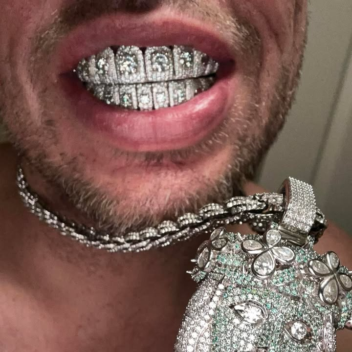 Honeymoon Set Blue Moissanite Custom Grillz
