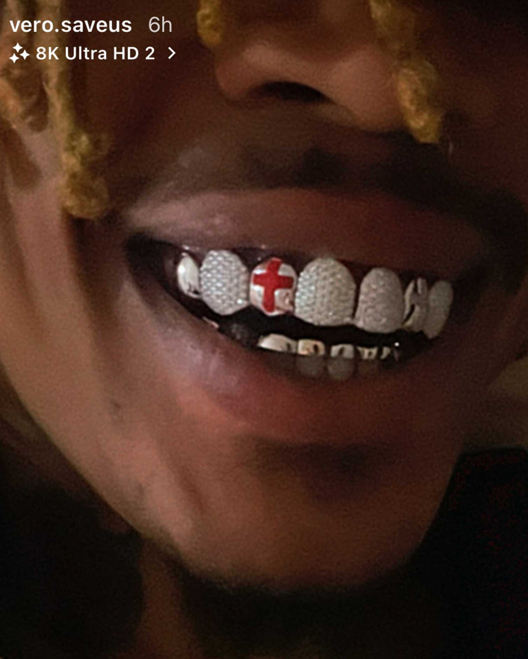 Cross Style Designer Collaboration Custom Grillz