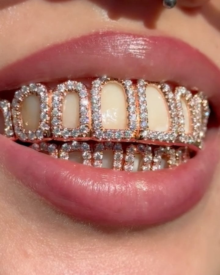 Open Face Custom Moissanite Grillz
