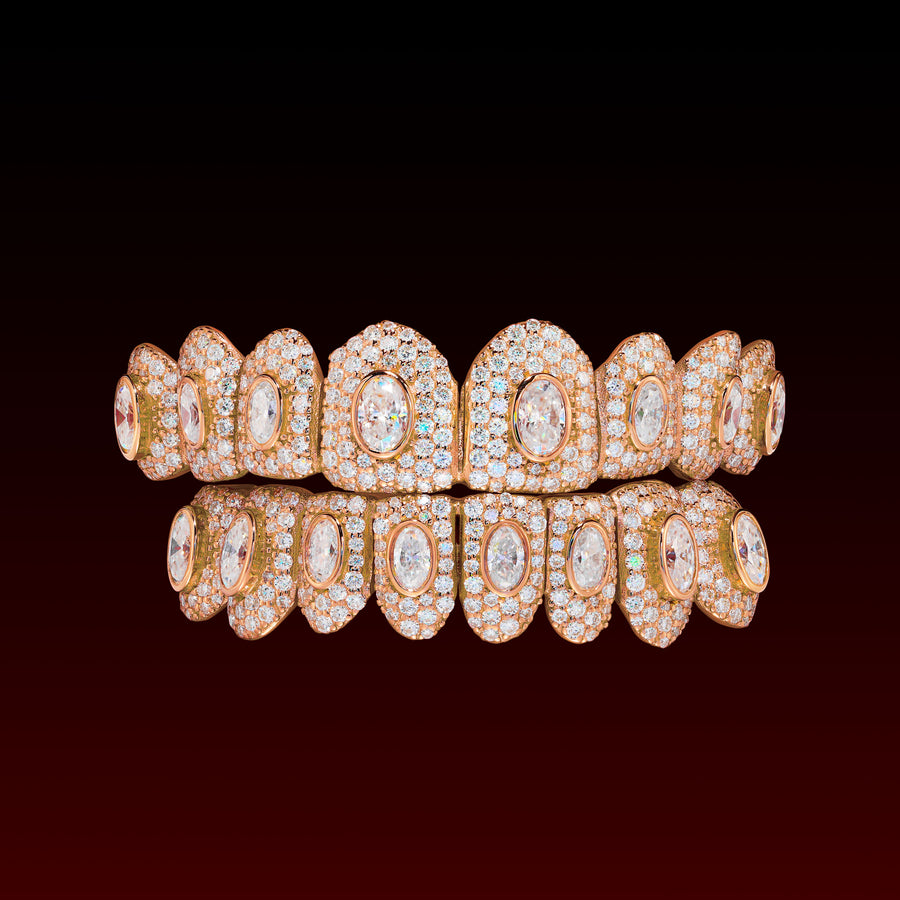 Oval Cut Honeymoon Custom Moissanite Grillz
