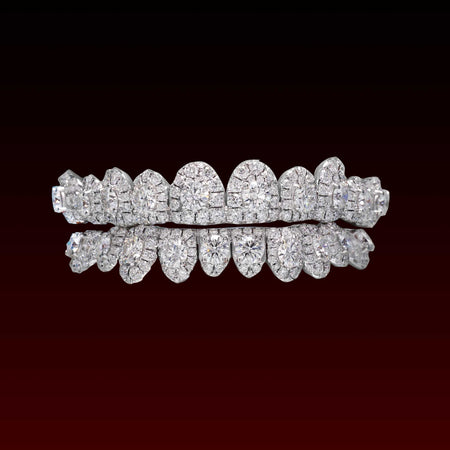50 Pointer Center  Stone Custom Moissanite Grillz