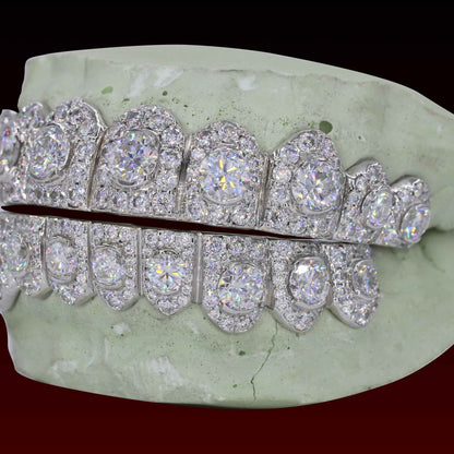 50 Pointer Center  Stone Custom Moissanite Grillz