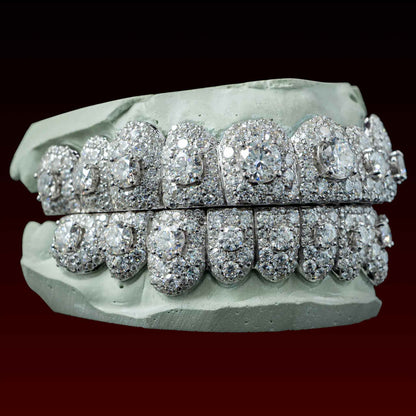 50 Pointer Center  Stone Custom Moissanite Grillz