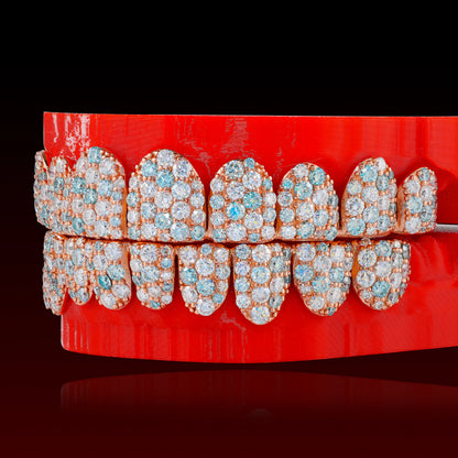 Blue & White Jumbo Set Custom Moissanite Grillz