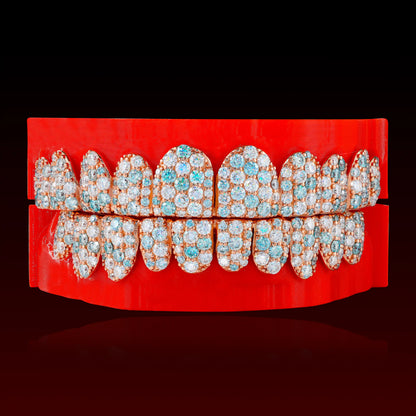 Blue & White Jumbo Set Custom Moissanite Grillz