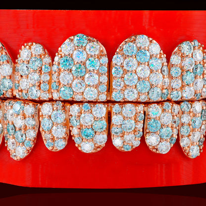 Blue & White Jumbo Set Custom Moissanite Grillz