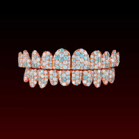 Blue & White Jumbo Set Custom Moissanite Grillz