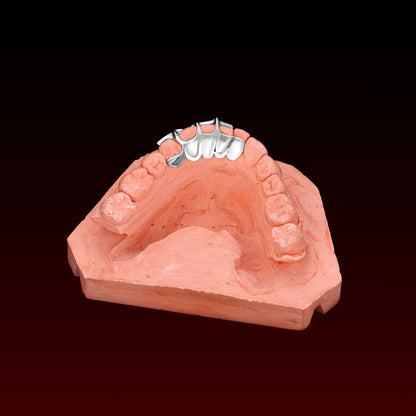 Falling Star Custom Grillz