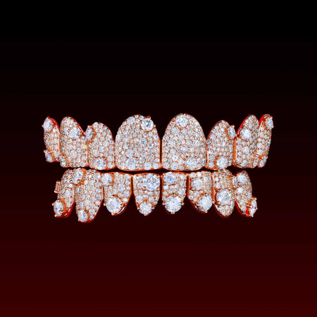 Mosaic Set Moissanite Custom Grillz