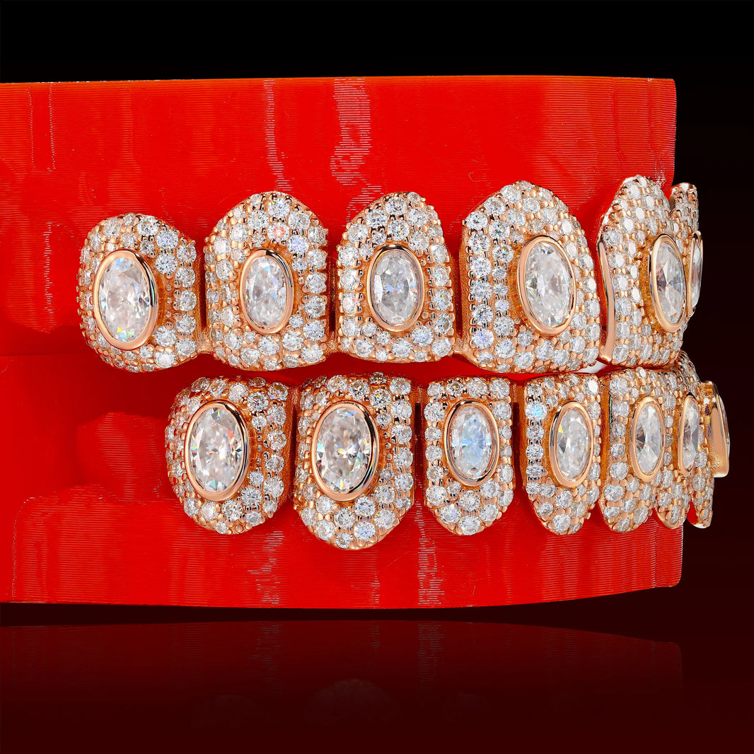 Oval Cut Honeymoon Custom Moissanite Grillz