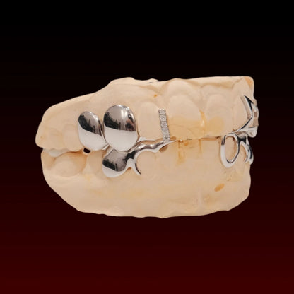 Star Cap Designer Custom Grillz
