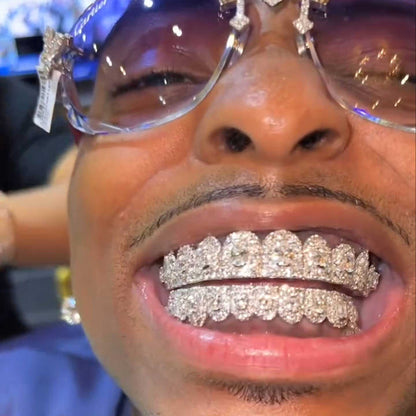 50 Pointer Center  Stone Custom Moissanite Grillz