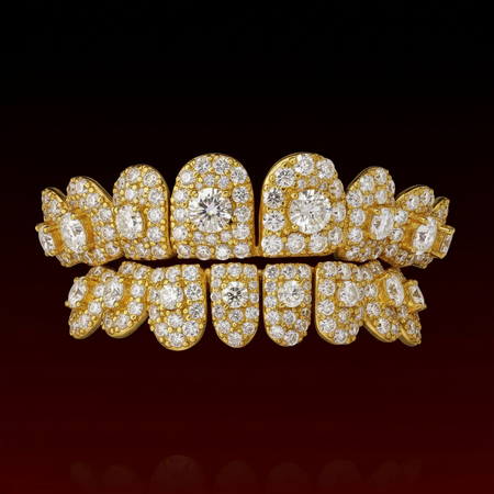 50 Pointer Center Stone Custom Moissanite Grillz