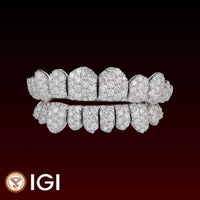 Lab-Grown Diamond Jumbo Set Custom Grillz