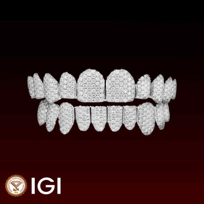 Lab-Grown Diamond Honeycomb Set Custom Grillz