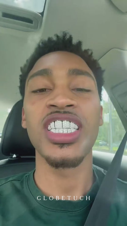 Jumbo Set Custom Moissanite Grillz