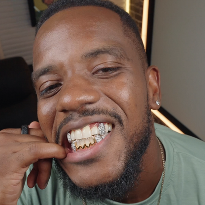 Diamond Cut Open Face Custom Grillz